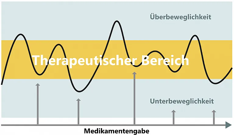 Überbeweglichkeit und Unterbeweglichkeit von Parkinson-Patienten während der Medikamentengabe